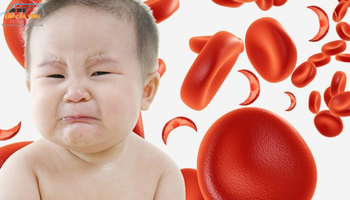 Nguyên nhân trẻ em thiếu máu